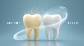 デュアルホワイトニングをした前後の歯のイメージ