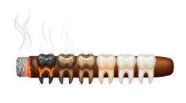 喫煙で歯が悪くなっていくイメージ