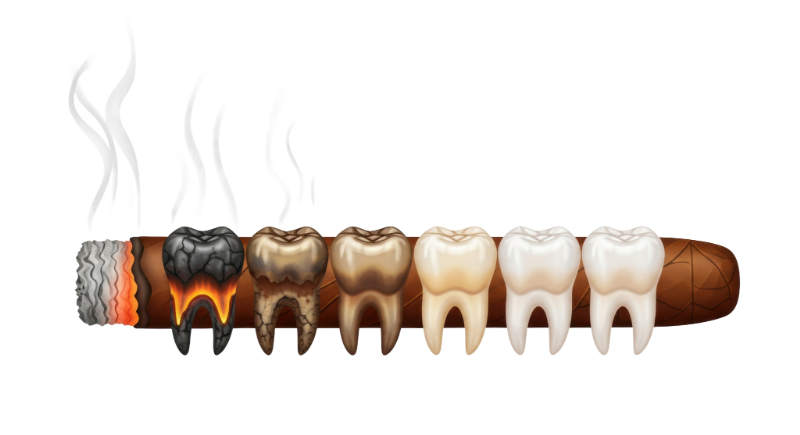 喫煙で歯が悪くなっていくイメージ